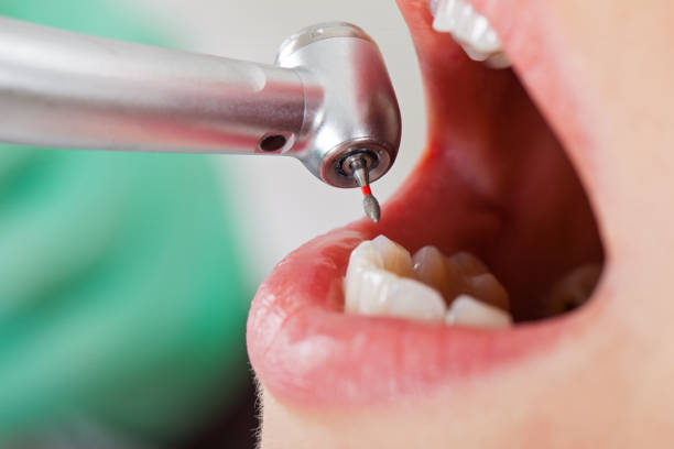 Best Walk-In Emergency Dentist in Pink, OK